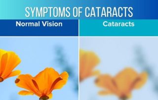 Recognizing the Symptoms of Cataracts